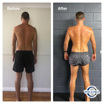 Wellora Back Hero Posture Corrector v2