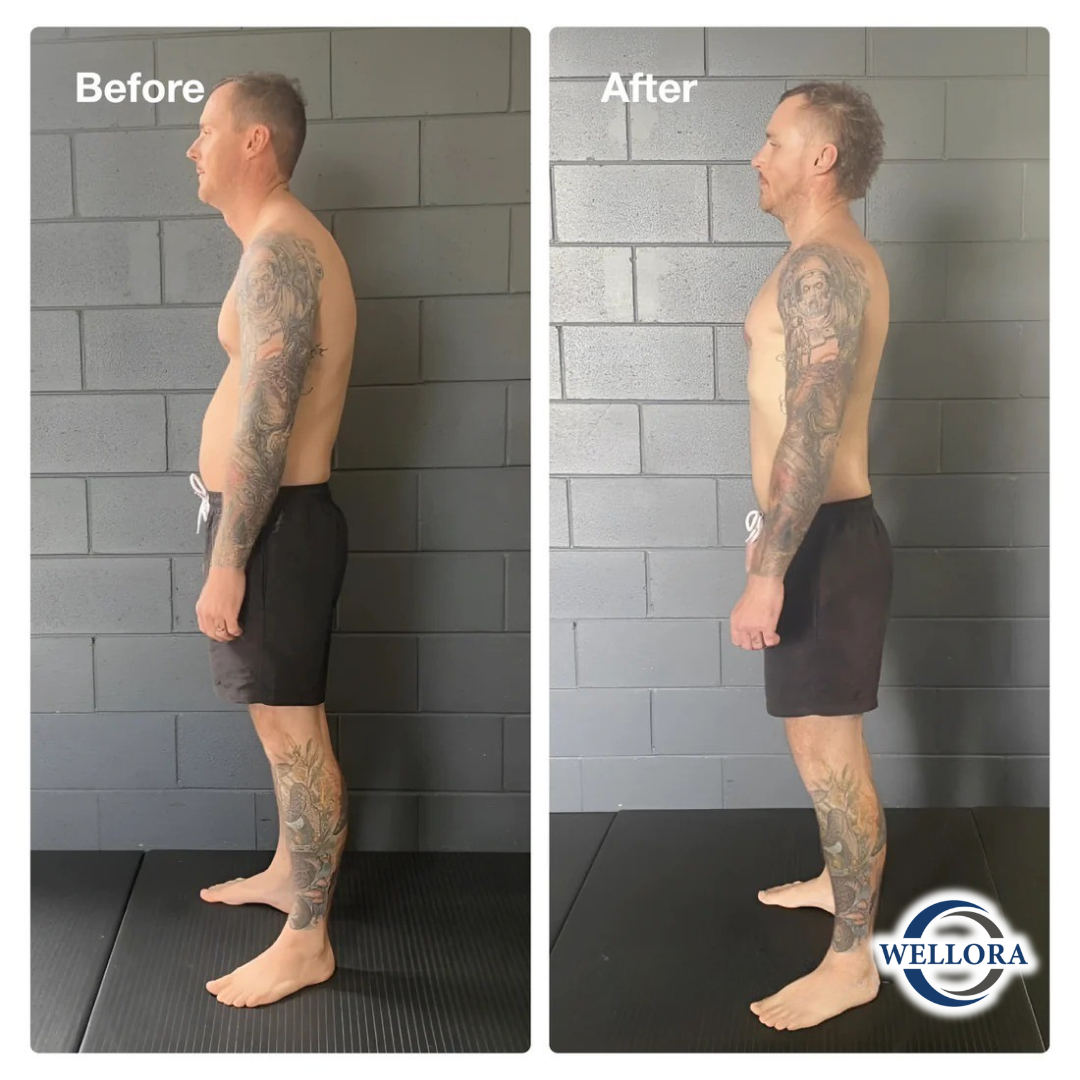 Wellora Back Hero Posture Corrector v2